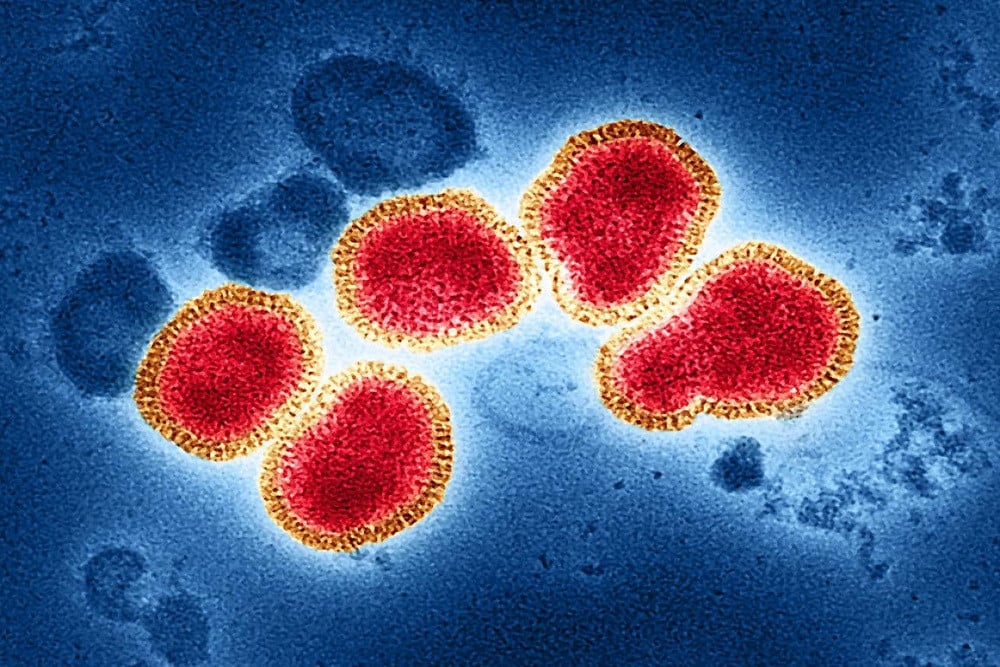 10 Fakta Hantavirus, Mengenal Gejala, Cara Penularan, dan Wabah di Kapal MV Hondius